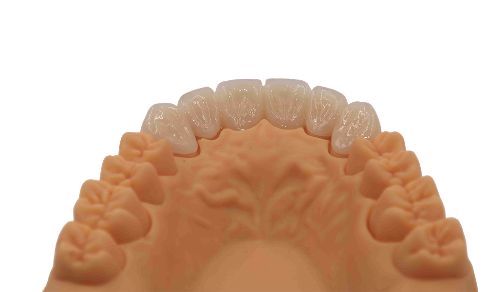 Layered Zirconia