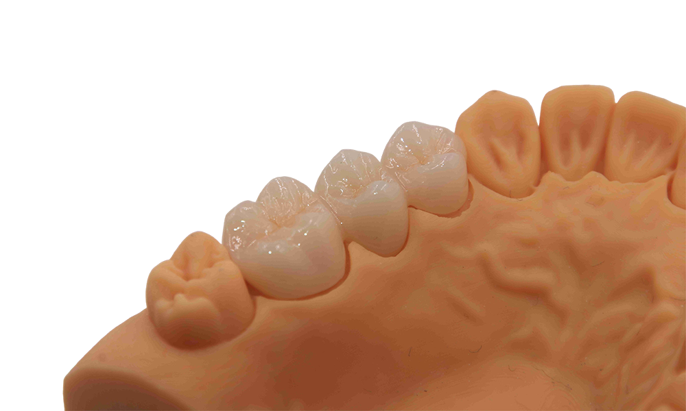 Layered Zirconia