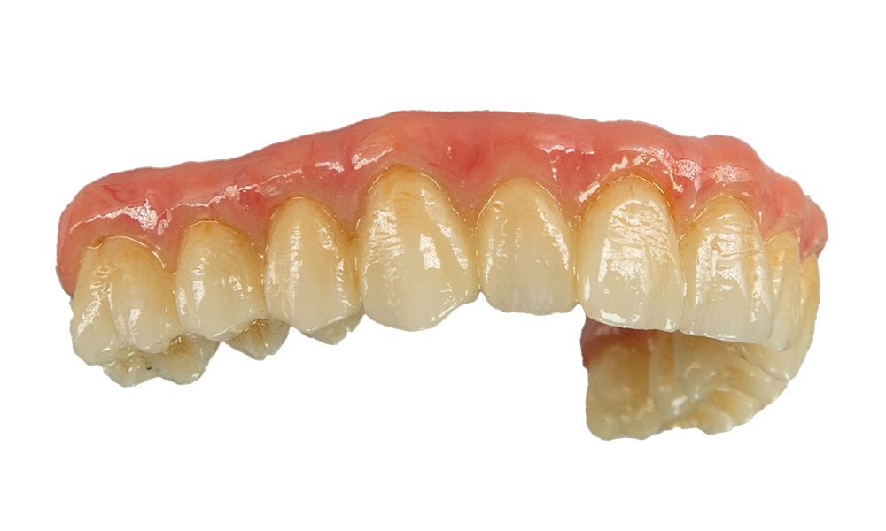 Layered Zirconia